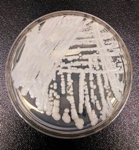 Dutch authorities preparing for outbreak of candida auris, a fungus that can be lethal