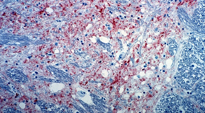 Dutch mad cow disease case concerns variant that is less dangerous for humans