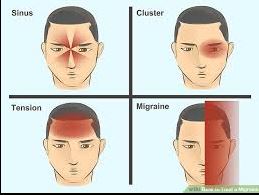 Migraines